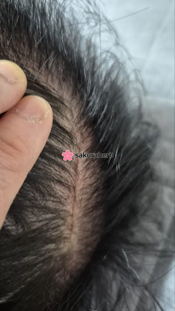 ${review_item.post_title}