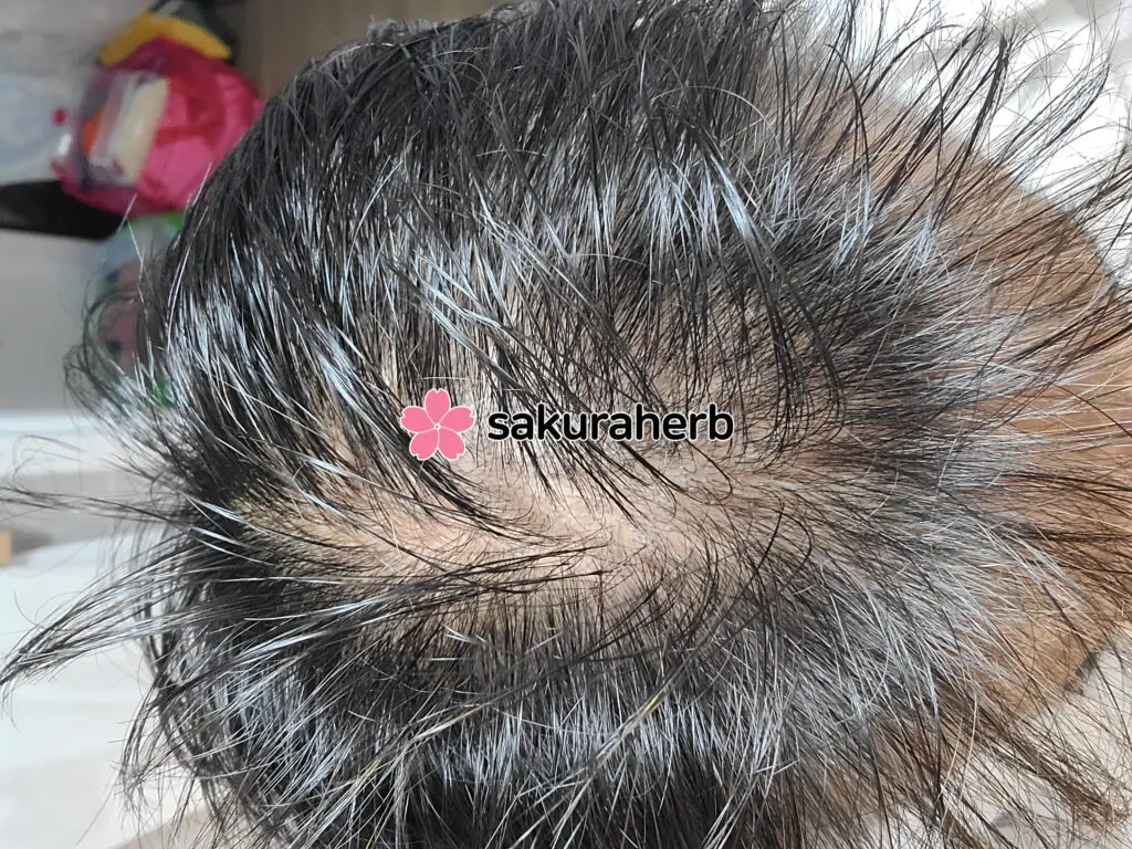 ${review_item.post_title}