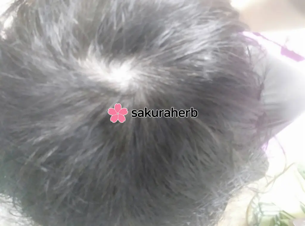 ${review_item.post_title}