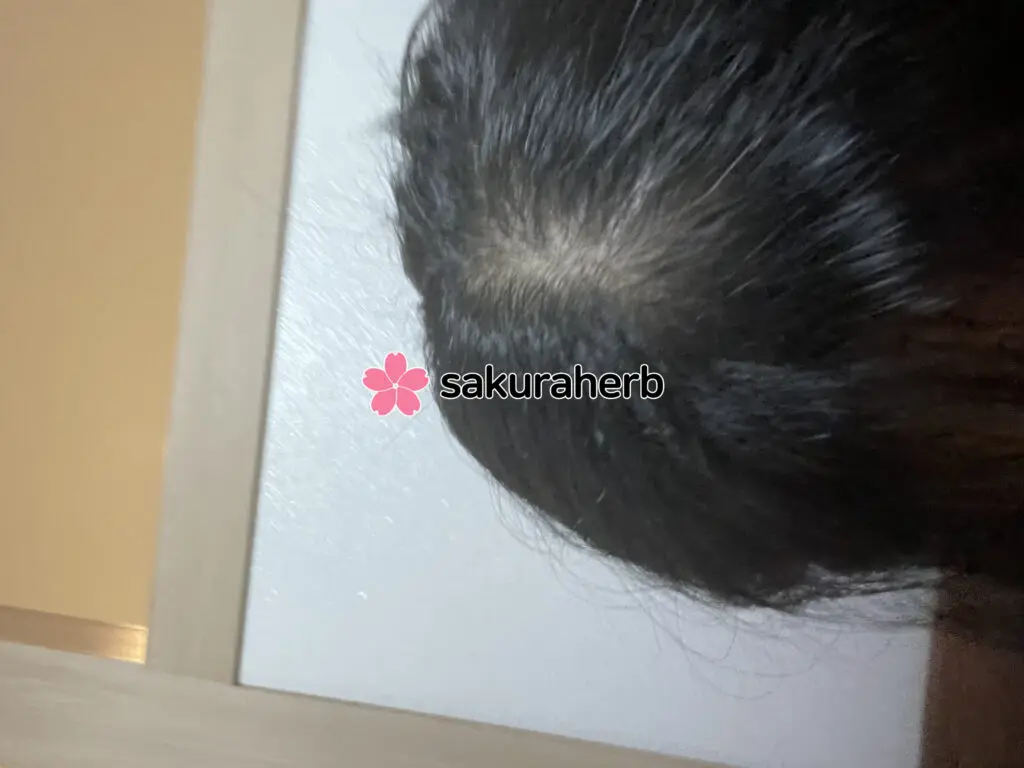 ${review_item.post_title}