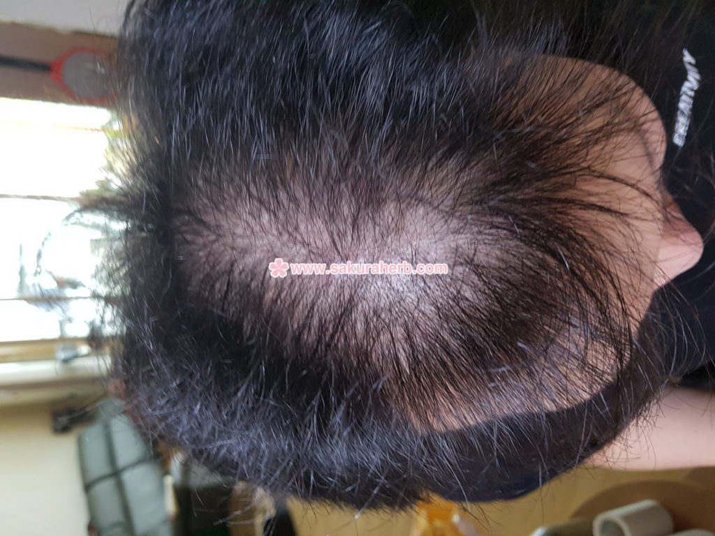 ${review_item.post_title}