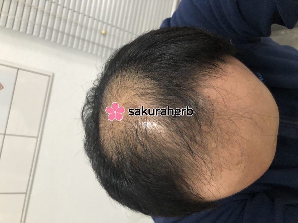 ${review_item.post_title}