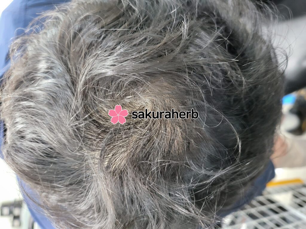 ${review_item.post_title}