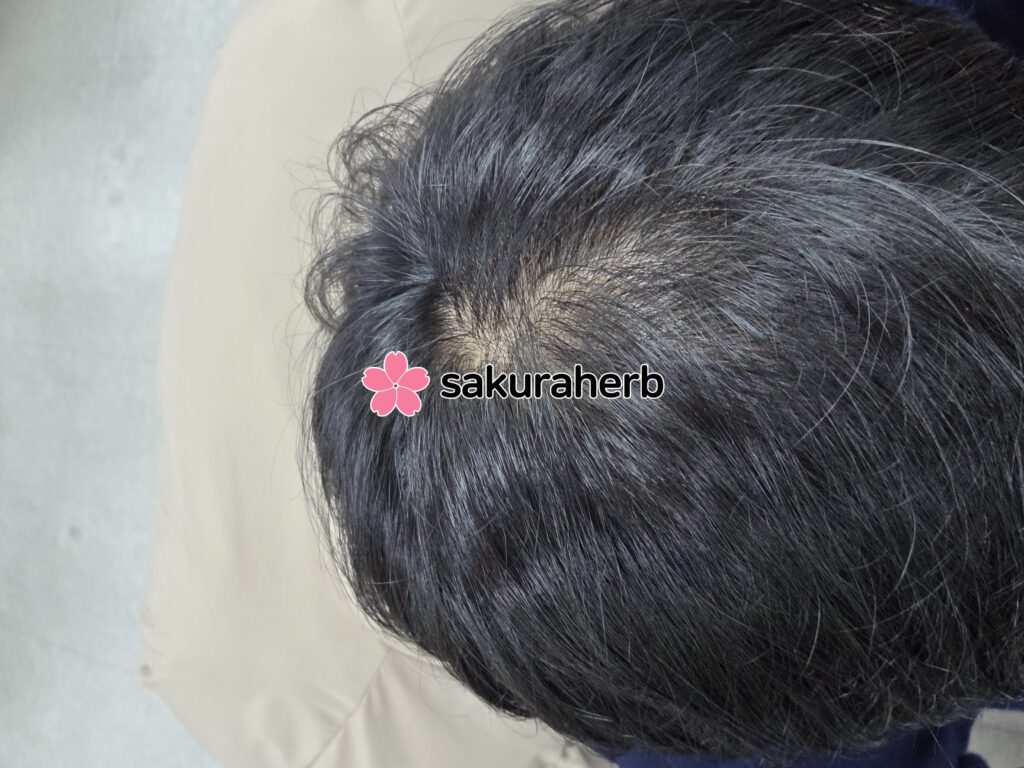 ${review_item.post_title}